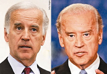 �ݵ�Ҳ���� ��ָ����(j��ng)���^��Ƥ�������g(�D)